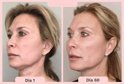 Masajeador de Microcorriente Facial