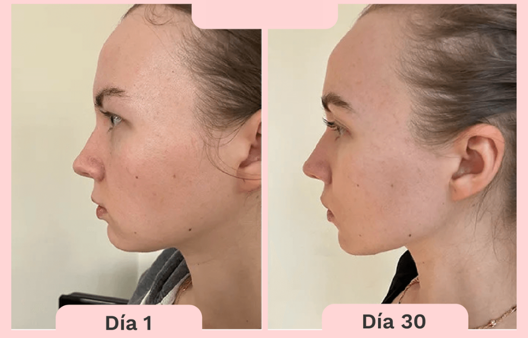 Masajeador de Microcorriente Facial