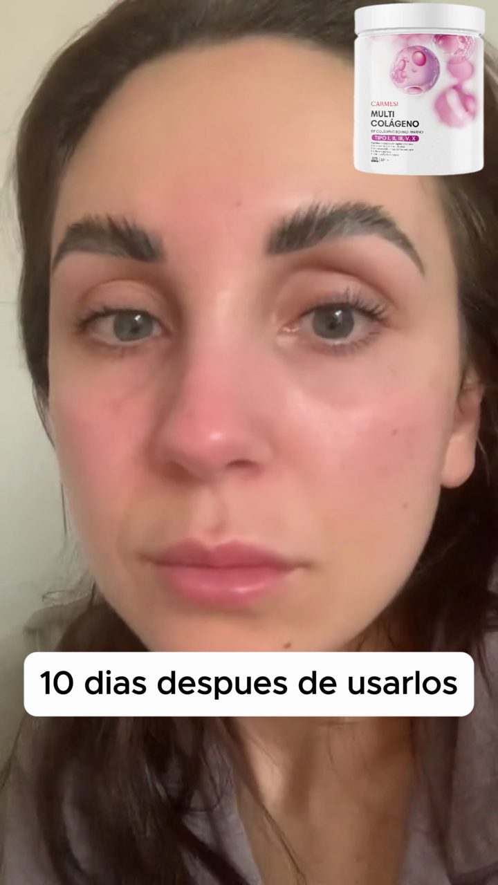 Colágeno