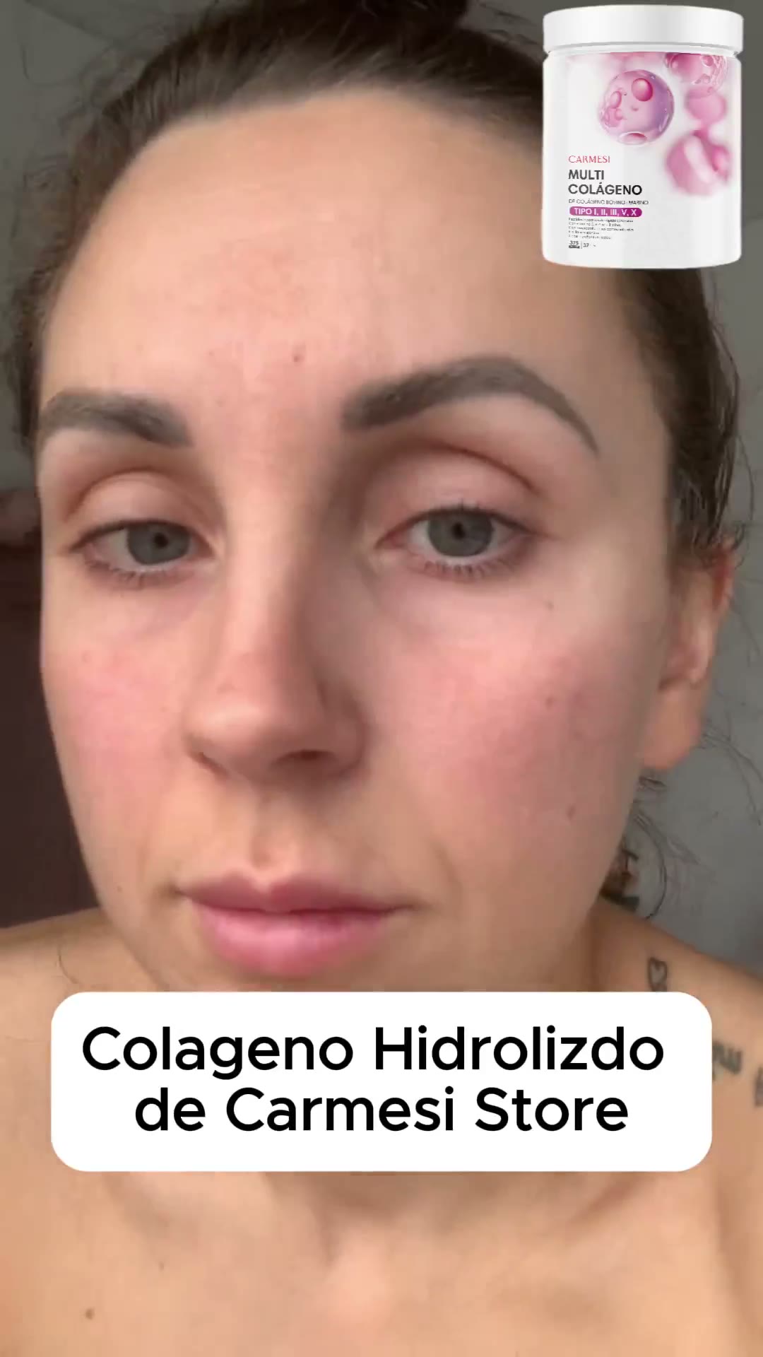 Colágeno