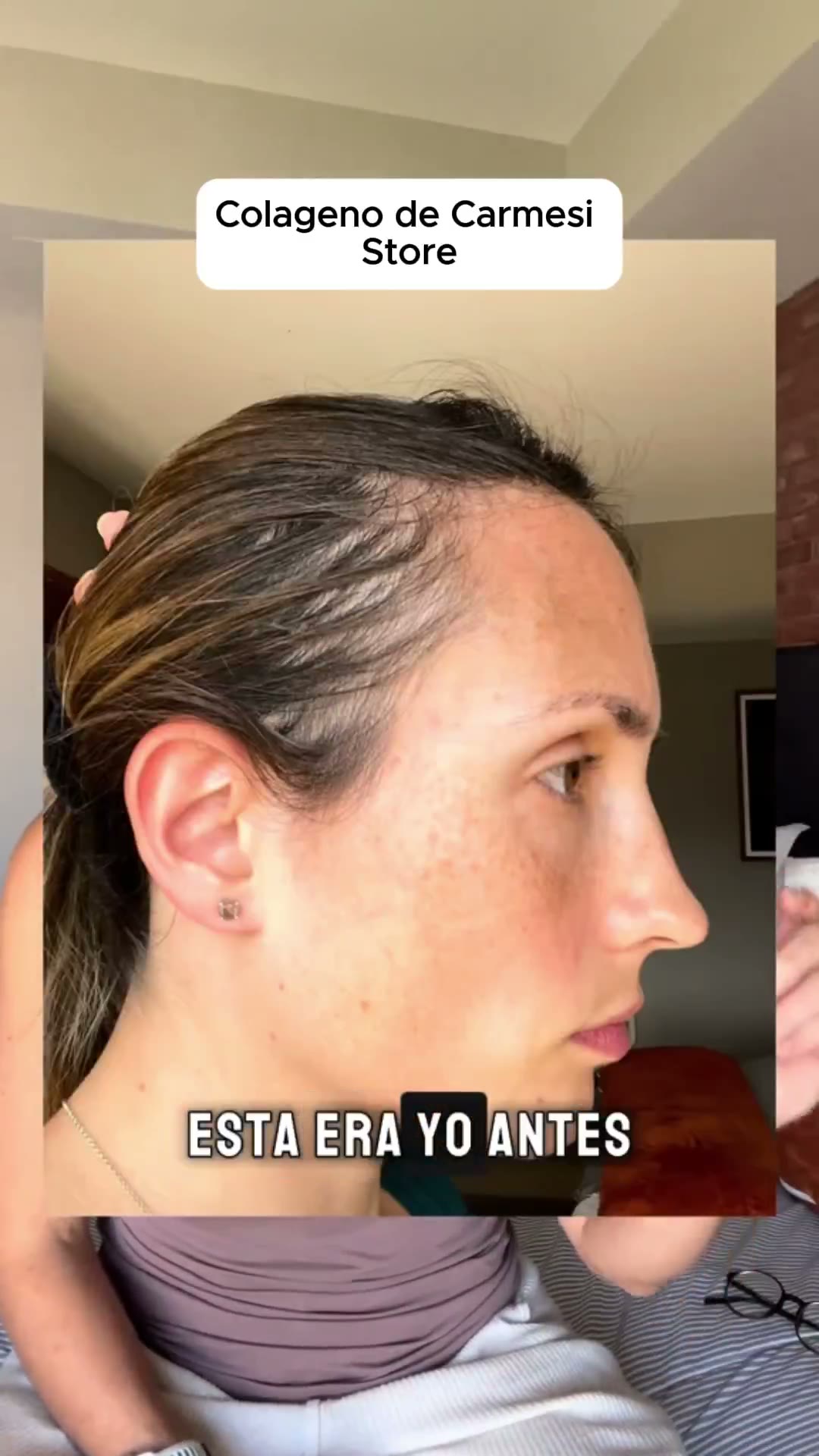 Colágeno