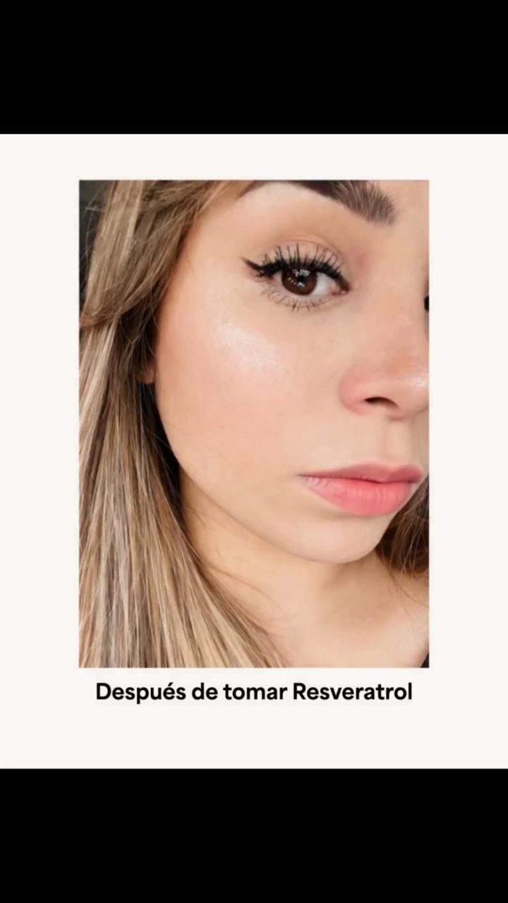 Resveratrol